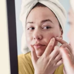 Address common skin concerns with customized chemical peeling approaches for improvement