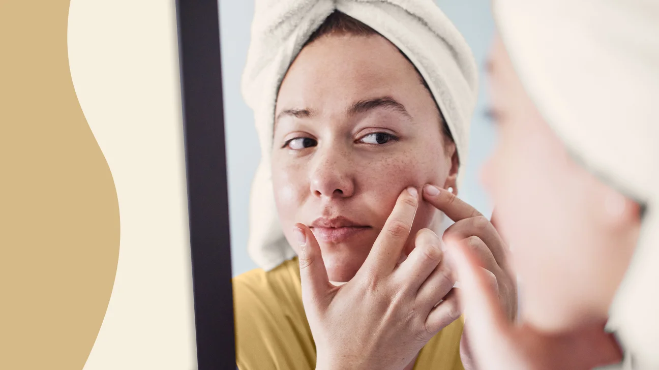 Address common skin concerns with customized chemical peeling approaches for improvement